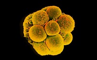 Технологию CRISPR можно использовать для создания устойчивости к ВИЧ